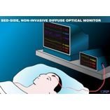 Transcranial, non-invasive neuro-monitoring with diffuse optics | ICFO